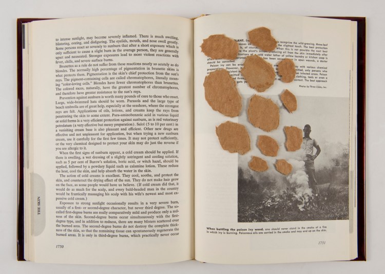 "The Re-Illustrated Medical Encyclopedia" Mixed media in 1960 medical encyclopedia